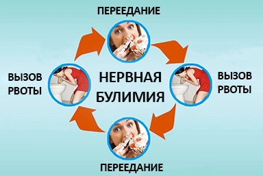 Лечение булимии в Саратове
